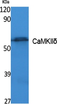 CaMKII delta antibody