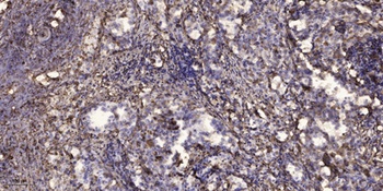 SNM1B antibody