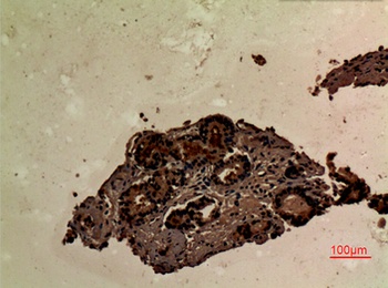 SLP-76 antibody