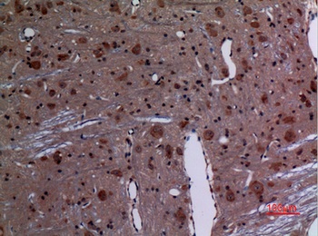 Rab 26 antibody