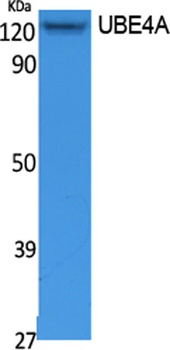 UBE4A rabbit pAb Antibody