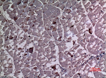 UBE4A rabbit pAb Antibody