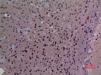 TudorSN antibody