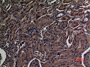 ZNF227 rabbit pAb