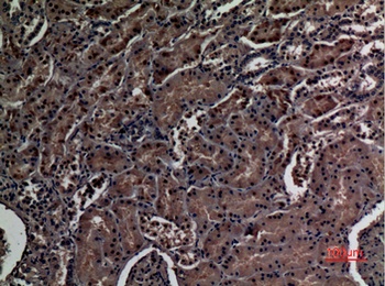 ZNF227 antibody