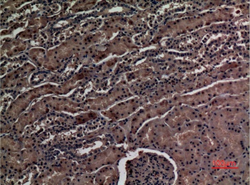 ZNF227 rabbit pAb