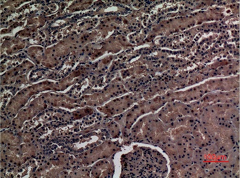 ZNF227 antibody