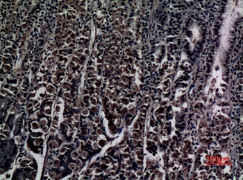 ZNF227 antibody