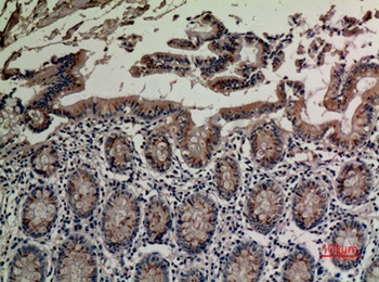 TRPV3 rabbit pAb