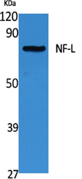 NF-L rabbit pAb Antibody