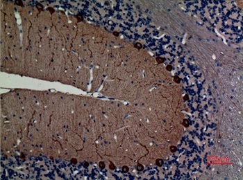 NF-L antibody