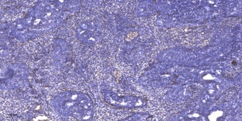 SCML2 antibody