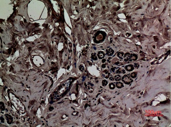 SLC6A14 antibody