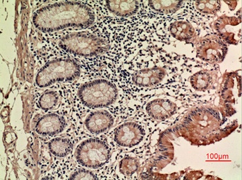 LIF antibody