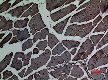 Actin-alpha cardiac muscle antibody