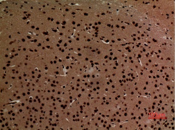 K-cadherin rabbit pAb