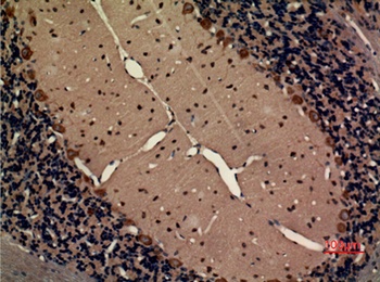 Fractalkine Receptor rabbit pAb