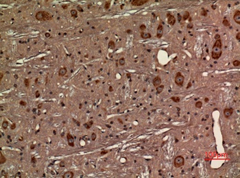 Fractalkine Receptor rabbit pAb