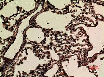 JAM-B antibody