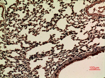 JAM-B antibody