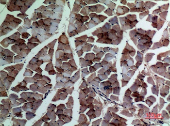 ACTA2 antibody