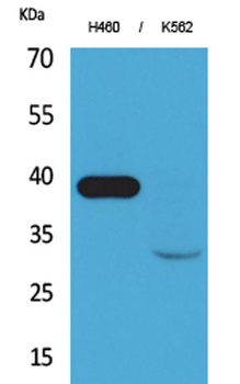 Cathepsin L antibody