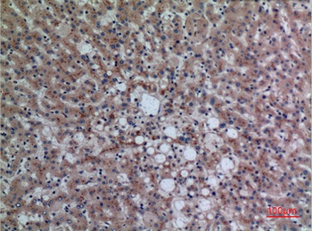 DPP7 rabbit pAb