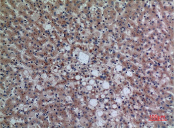 DPP7 antibody