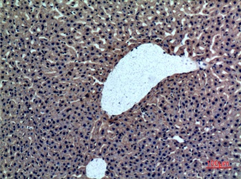 Prothrombin antibody