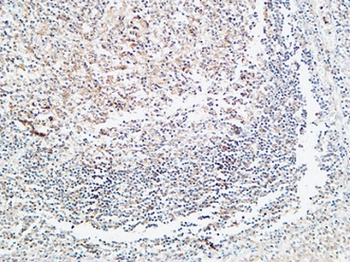 Prothrombin rabbit pAb