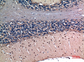 Latexin rabbit pAb Antibody