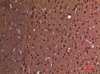 PGP9.5 antibody