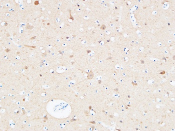 UCH-L1 rabbit pAb