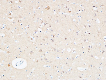 UCH-L1 rabbit pAb
