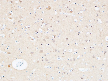 PGP9.5 antibody