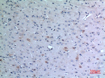 Eotaxin-3 antibody