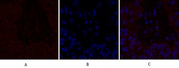 IL8 antibody