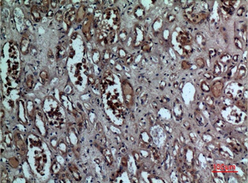 BNIP-3 rabbit pAb