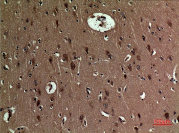 BNIP-3 rabbit pAb