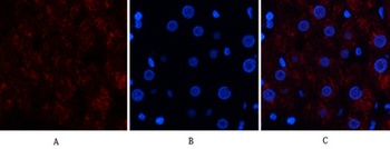 Catalase antibody