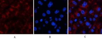 Catalase antibody