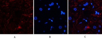 Catalase antibody