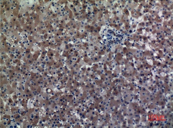 ALDH1A1 antibody