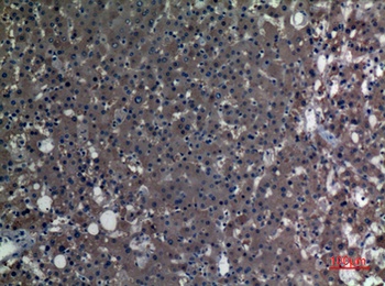 ALDH1A1 antibody