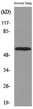 ALDH1A1 antibody