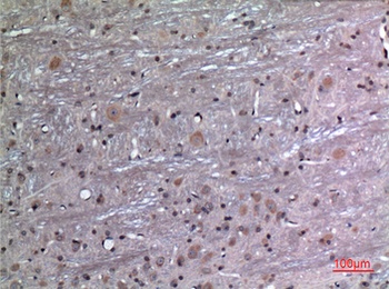 FGF-12 antibody