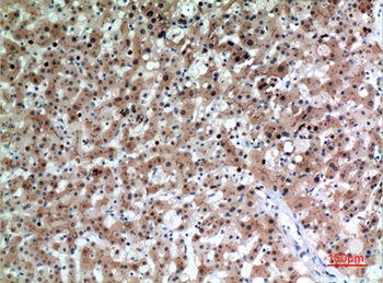 CD66e rabbit pAb