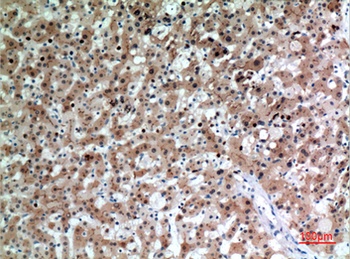 CD66e antibody