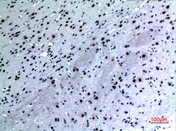 Cytokeratin 14 rabbit pAb