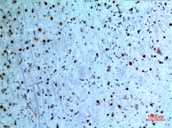 Cytokeratin 14 rabbit pAb